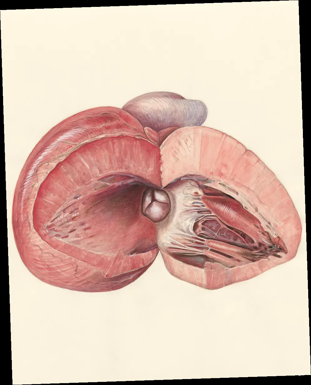 다양한 췌장 물혹 종류, 나는 어떤 걸까요?